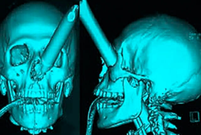 crazy x-ray pics