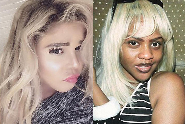 Celebrities who took plastic surgery too far
