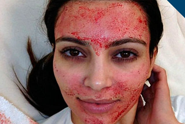 dangerous beauty treatments