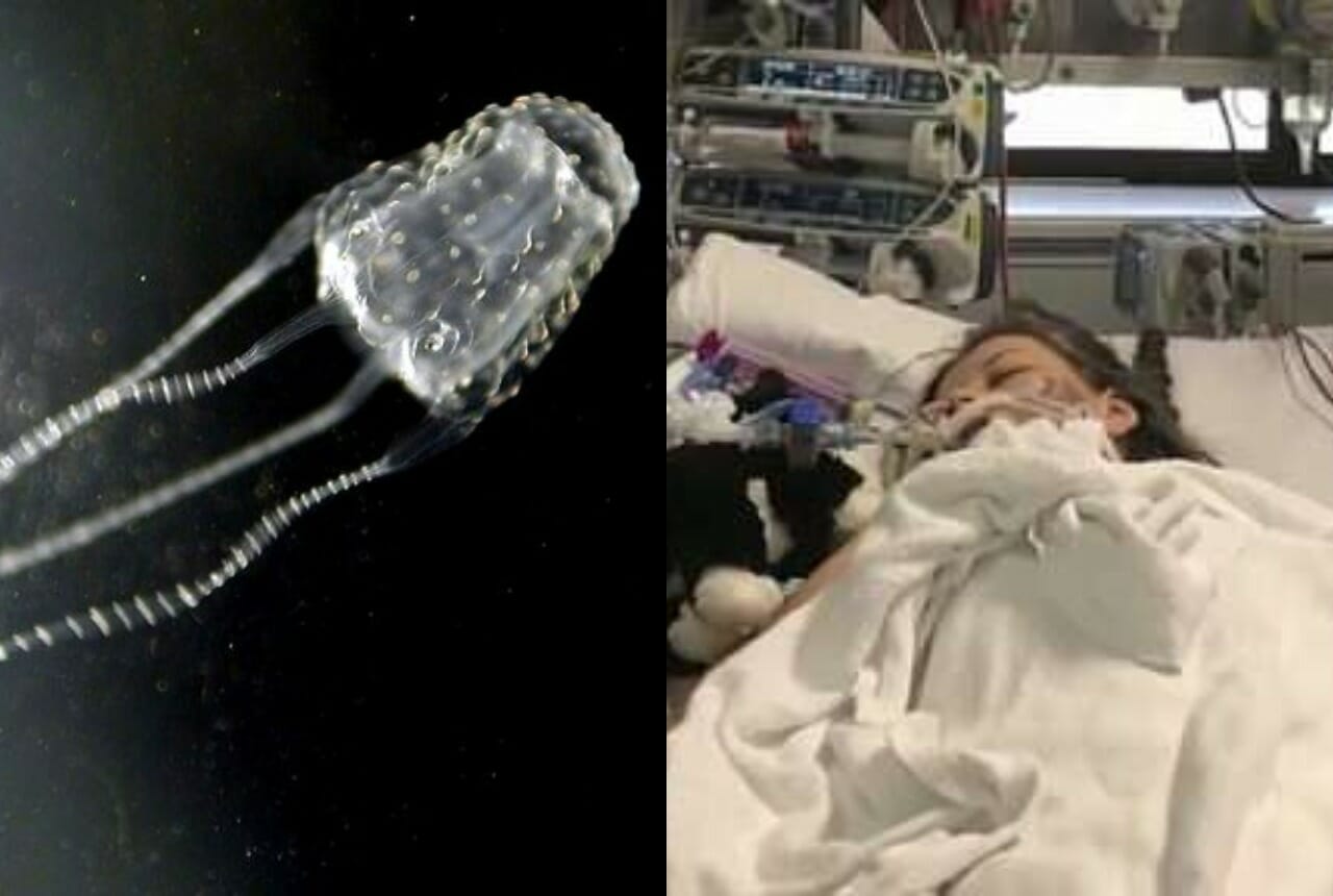 painful sting from the world's deadliest jellyfish