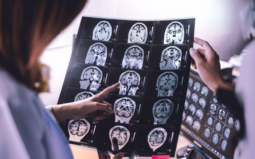 Brain scans